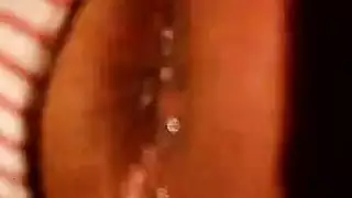 درعو مجبثة